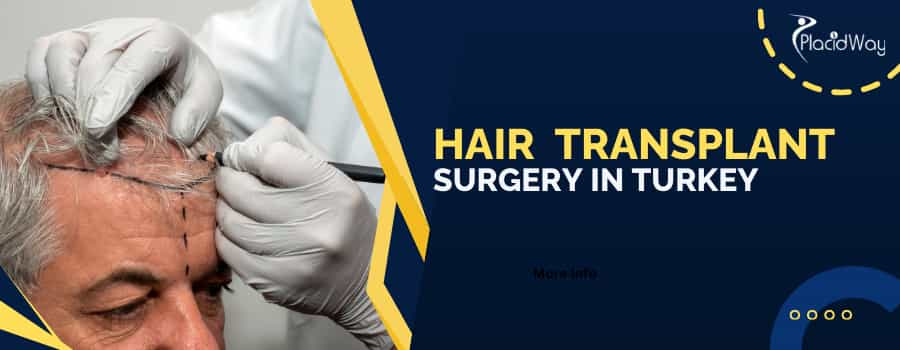 Hair Transplant Surgery in Turkey