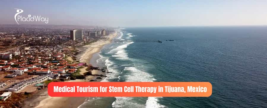 Medical Tourism for Stem Cell Therapy in Tijuana, Mexico