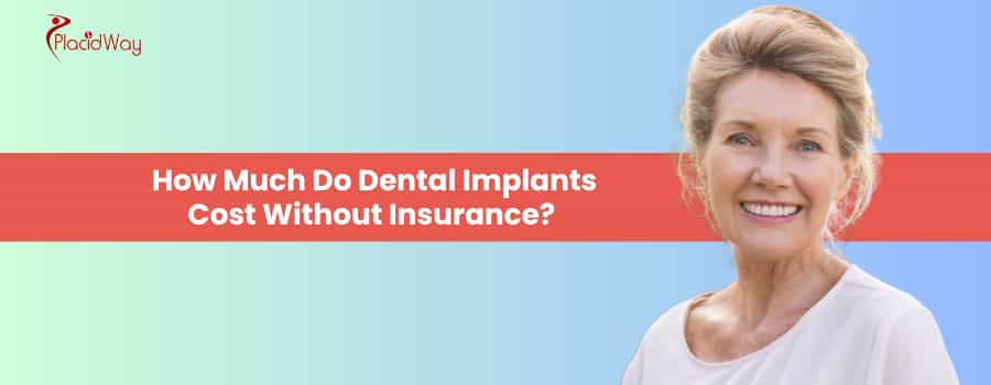 How Much Do Dental Implants Cost Without Insurance? 