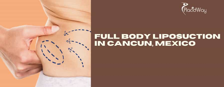 Full Body Liposuction in Cancun, Mexico