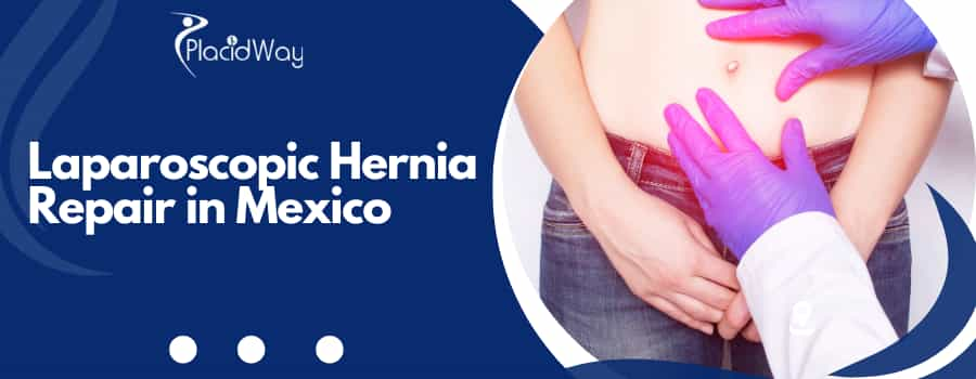 Laparoscopic Hernia Repair in Mexico