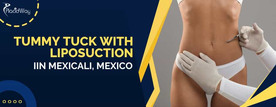 Tummy Tuck with Liposuction in Mexicali, Mexico