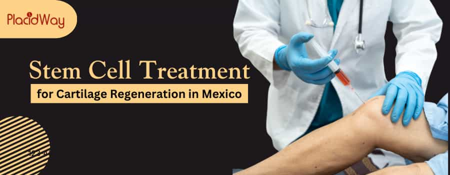 Stem Cell Treatment for Cartilage Regeneration in Mexico