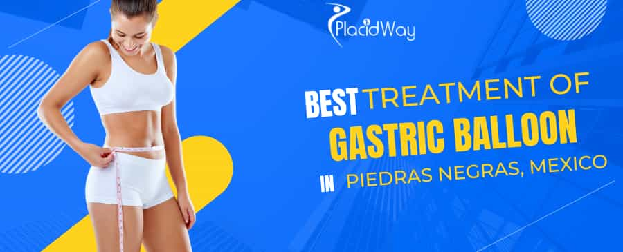 Best Treatment of Gastric Balloon in Piedras Negras, Mexico