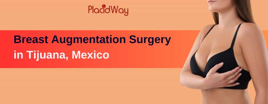 Breast Augmentation Tijuana Mexico