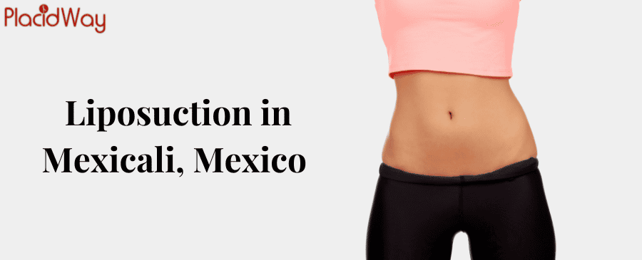 Liposuction in Mexicali, Mexico