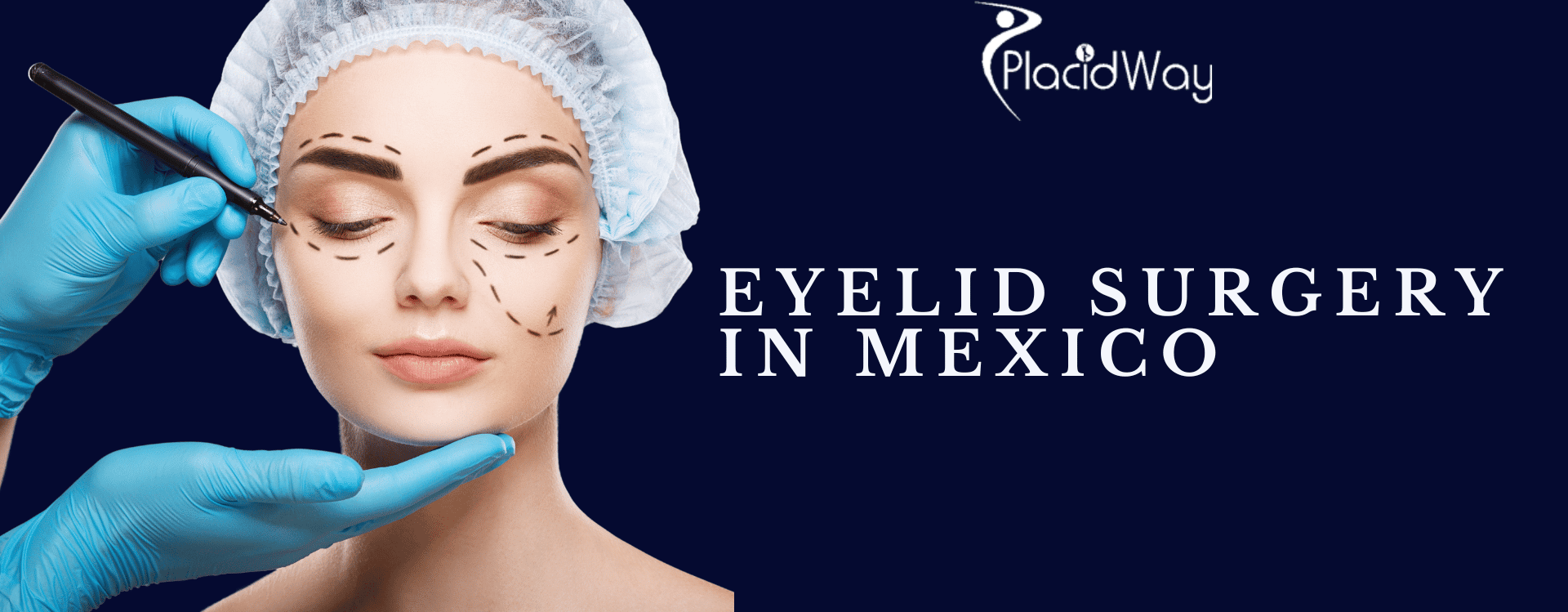 Eyelid Surgery in Mexico