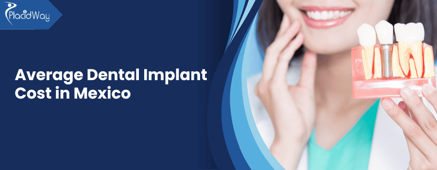 Average Dental Implant Cost in Mexico