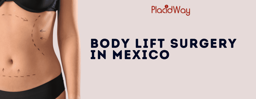 Body Lift Surgery in Mexico