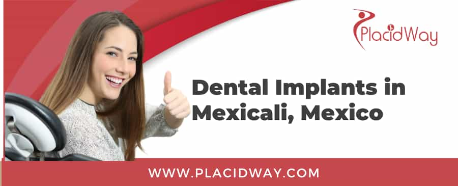 Dental Implants in Mexicali, Mexico