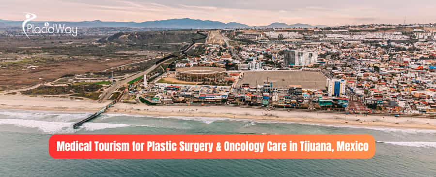 Medical Tourism for Plastic Surgery and Oncology Care in Tijuana, Mexico