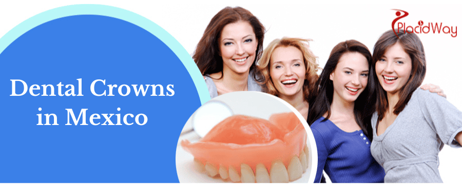 Dental Crowns in Mexico