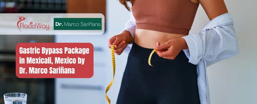 Gastric Bypass Package in Mexicali, Mexico by Dr. Marco Sariñana