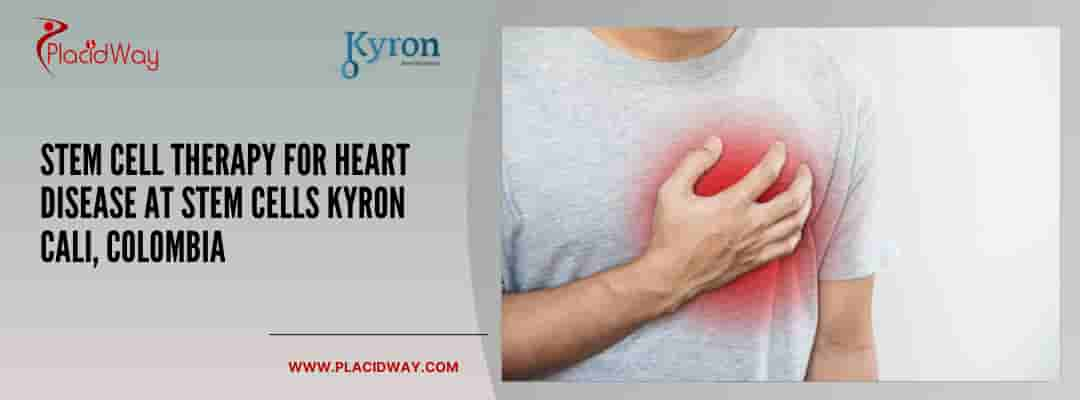 Stem Cell Therapy for Heart Disease at Stem Cells Kyron Cali, Colombia