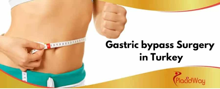 Cost of Gastric Bypass Surgery in Turkey