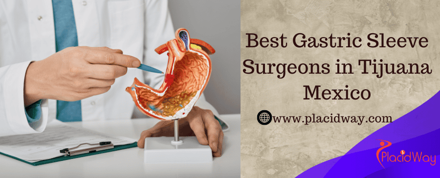 best gastric sleeve surgeon in tijuana mexico