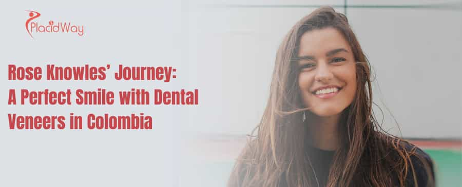 Rose Knowles’ Journey:  A Perfect Smile with Dental Veneers in Colombia