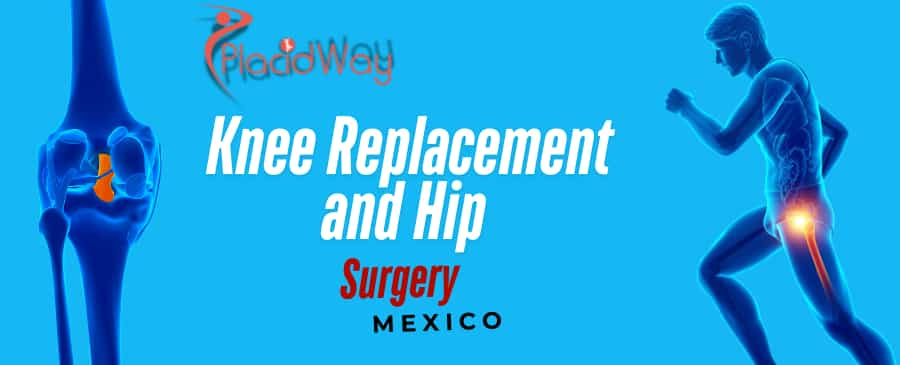  Mexico for Affordable Knee Replacement and Hip Surgeries