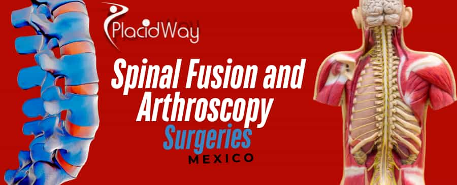 Guatemalan Patients Choose Mexico for Spinal Fusion and Arthroscopy Surgeries