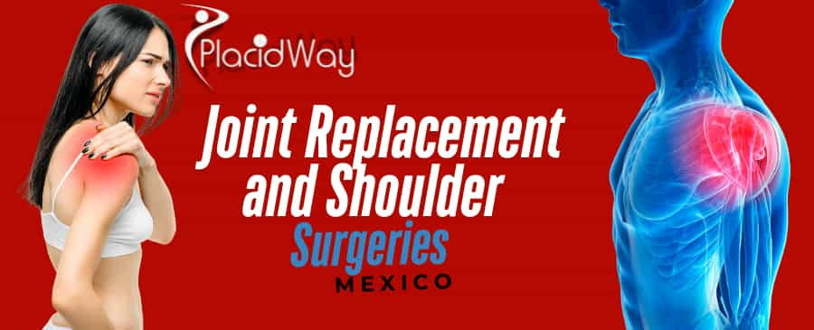 Why Colombian Patients Prefer Mexico for Joint Replacement and Shoulder Surgeries