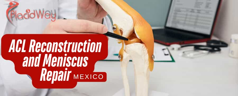 Mexico as the Top Destination for ACL Reconstruction and Meniscus Repair for Latin Americans