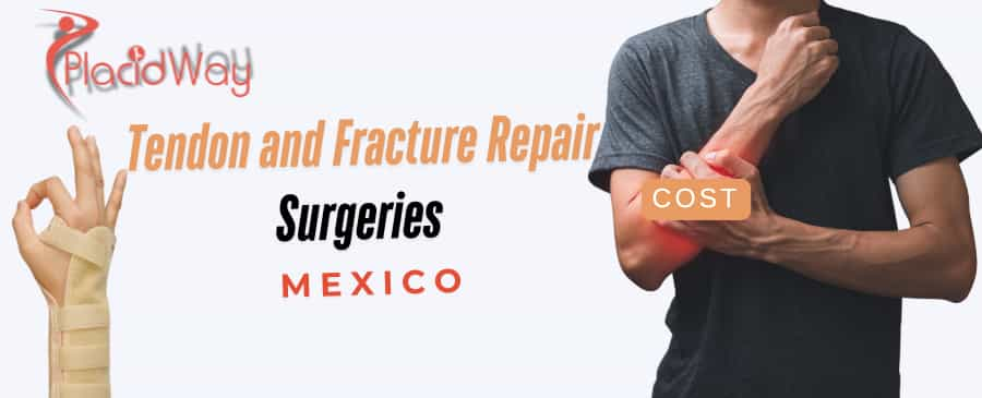 Tendon and Fracture Repair Surgeries in Mexico: Affordable Options for Latin American Patients