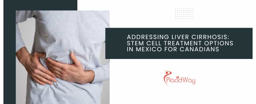 Addressing Liver Cirrhosis: Stem Cell Treatment Options in Mexico for Canadians