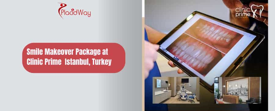 Smile Makeover Package in Istanbul, Turkey