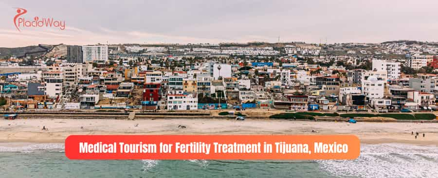 Medical Tourism for Fertility Treatments in Tijuana, Mexico