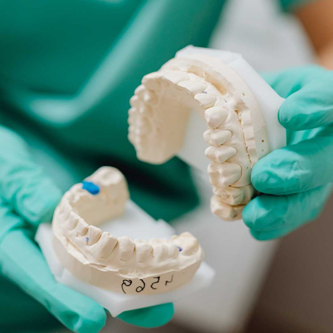 Best Dentures in Frontier Dental Mexicali Mexico