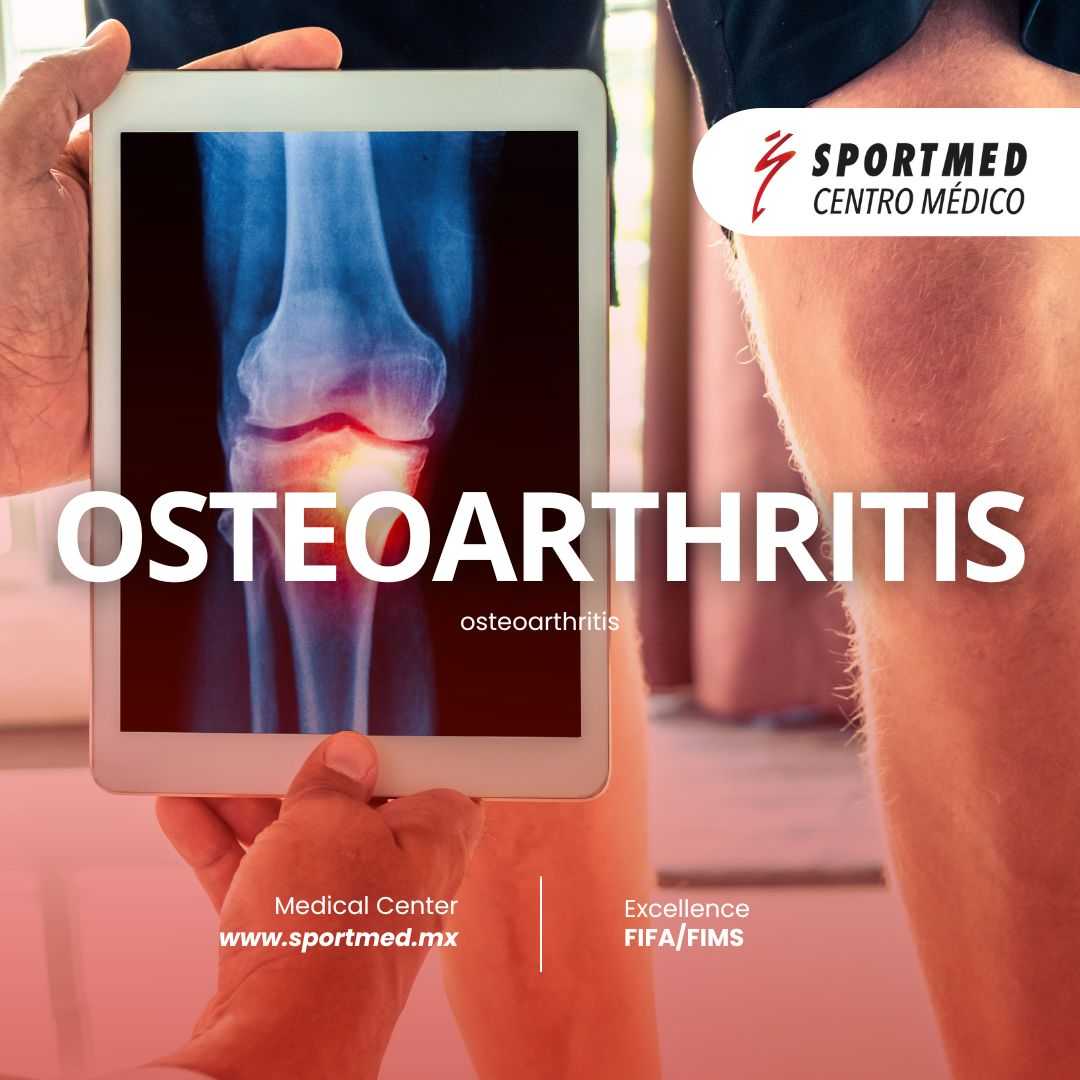 Rediscover Mobility with Advanced Stem Cell Therapy for Osteoarthritis