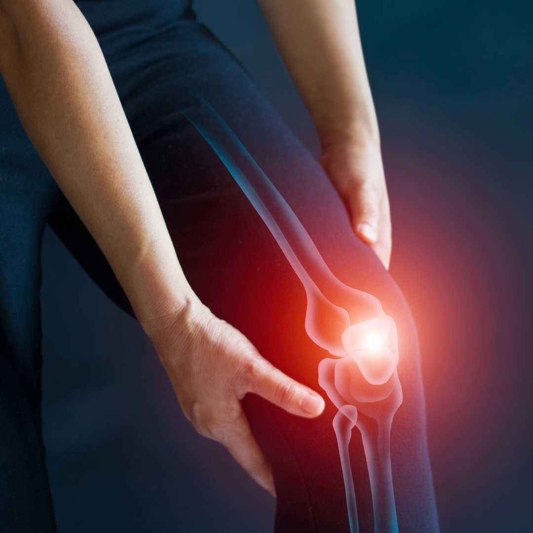 Stem Cell Therapy for Osteoarthritis Package in Tijuana, Mexico by CellsTime