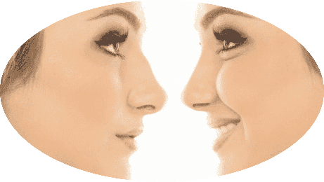 Nose Surgery Rhinoplasty Package at Cuba 