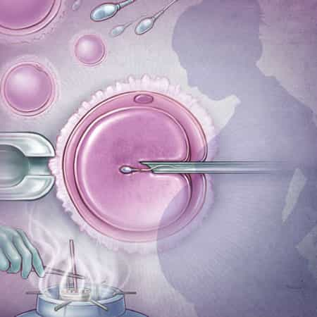 Stem Cell Therapy for Fertility Treatment Package at GIOSTAR Hospital Bengaluru, Bengaluru, India