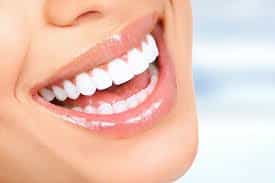 Hollywood Smile Package at Clinic Prime Istanbul, Istanbul, Turkey