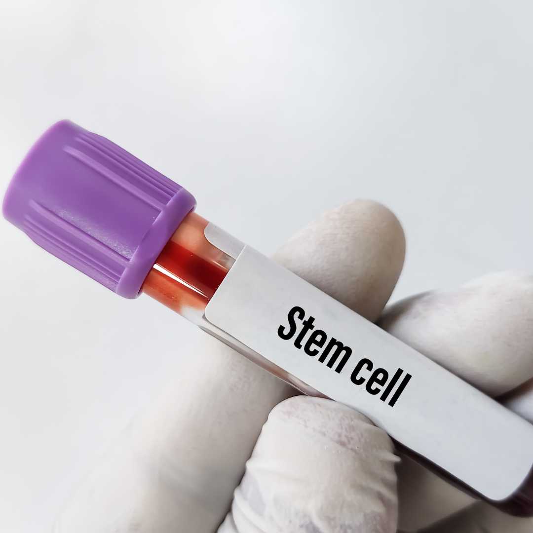Get advanced embryonic stem cell therapy package in Warsaw at $8,900.