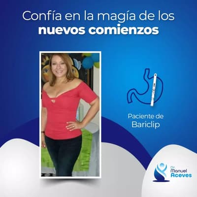 bariatric surgery in guadalajara mexico