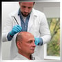 Stem Cell Treatment for Hair Loss in Cabo San Lucas, México thumbnail