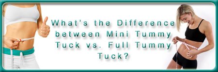 difference between mini tummy tuck and full
