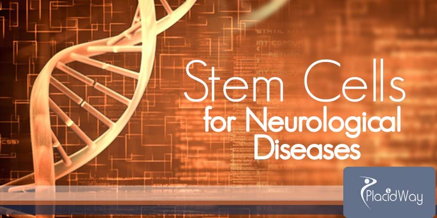 Stem Cell Therapy For Neurological Diseases Abroad