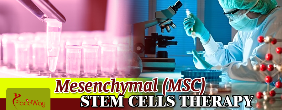 Mesenchymal Msc Stem Cells Therapy Treatment Abroad 9552