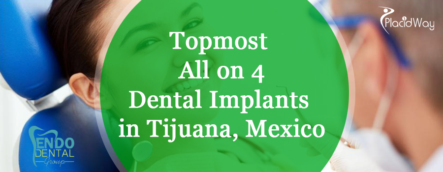 Topmost All On 4 Dental Implants In Tijuana Mexico