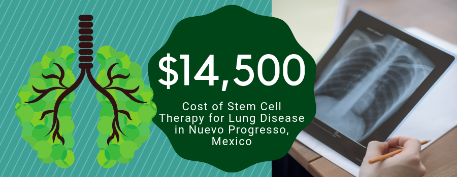 Cost Stem Cell Therapy for Lung Disease in Nuevo Progresso, Mexico