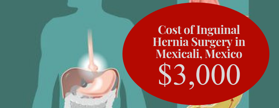 Inguinal hernia -  México