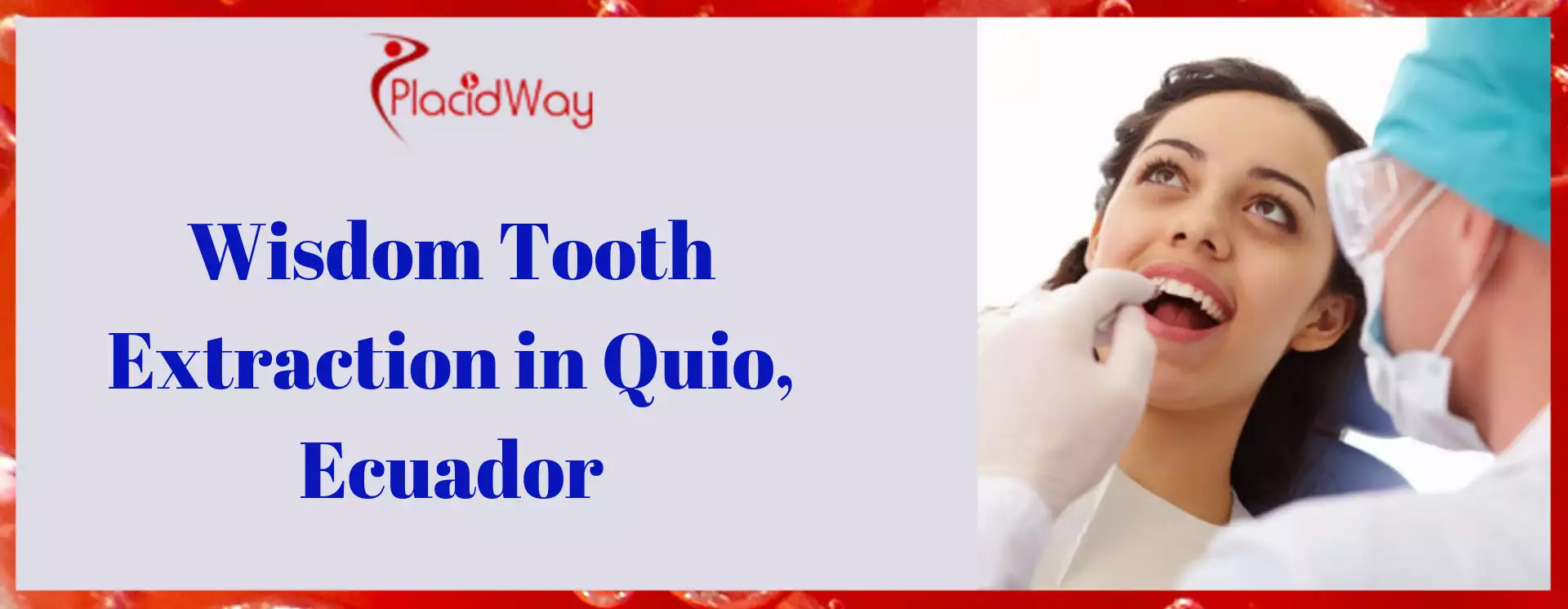 What Is The Average Cost Of Wisdom Tooth Extraction In Quito Ecuador