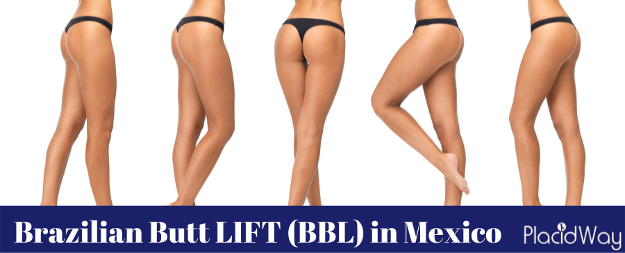 Frequently Asked Questions About BBL (Brazilian Butt Lift