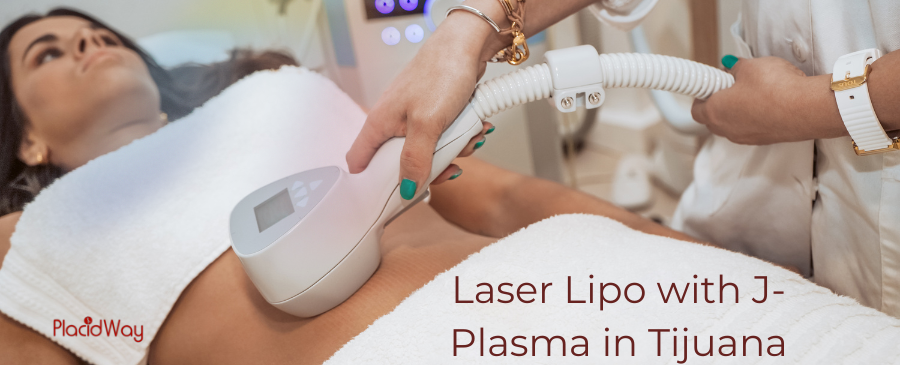 Laser Lipo With J Plasma In Tijuana Price At 5 500