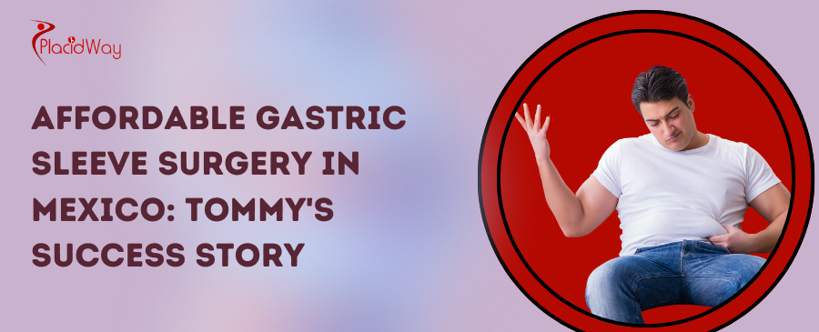 Affordable Gastric Sleeve Surgery in Mexico: Tommy's Success Story