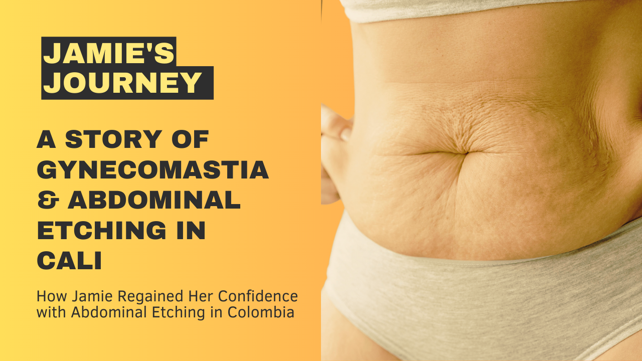 Jamie's Journey to Self-Confidence - Gynecomastia & Abdominal Etching in Cali