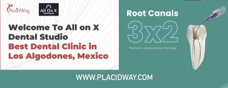 Root Canals in Mexico